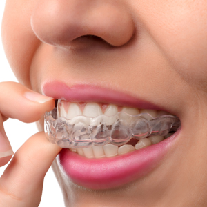 woman putting in clear braces