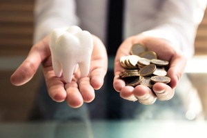 An up-close image of an artificial tooth in a person’s hand and money in their other hand