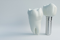 A model tooth standing next to a dental implant