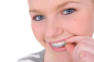 Protect your smile with good oral hygiene when using Invisalign in Collierville. 