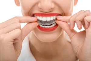 Why should I get Invisalign in Collierville?